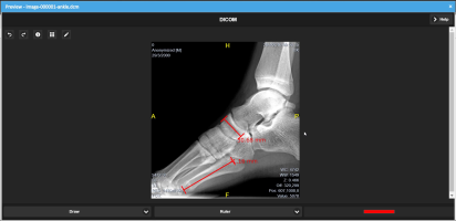 -DICOM-preview-foot